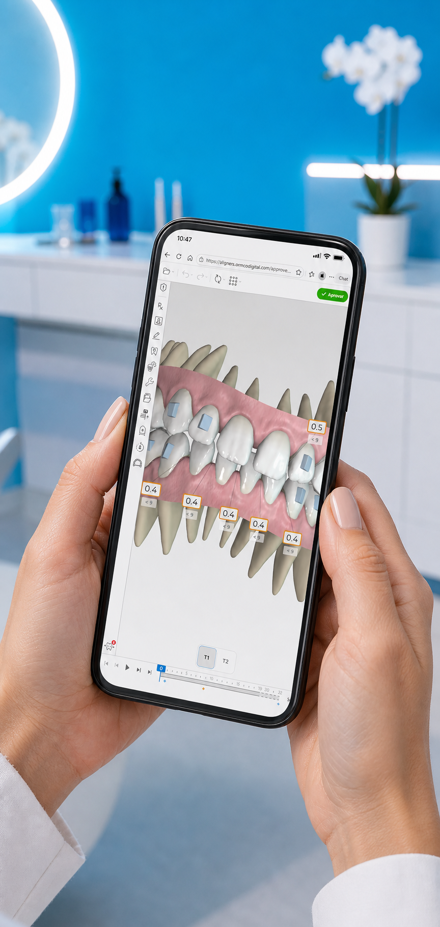 Spark Approval Software no planeamento digital 3D do tratamento com alinhadores Spark™