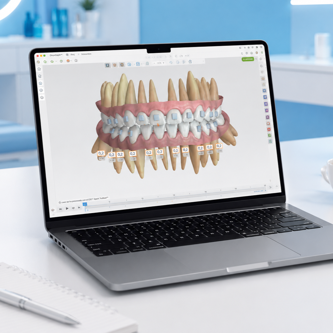 Spark Approval Software para planeamento digital 3D