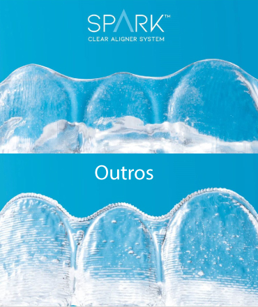 Comparação visual de transparência dos alinhadores Spark™