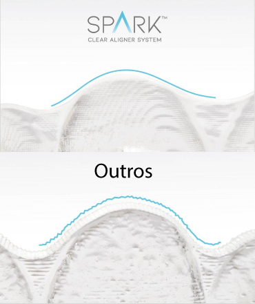Detalhe da superfície de um alinhador Spark™