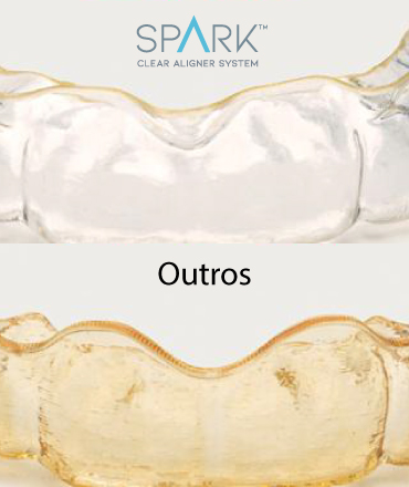 Comparação visual de resistência a manchas em alinhadores Spark™