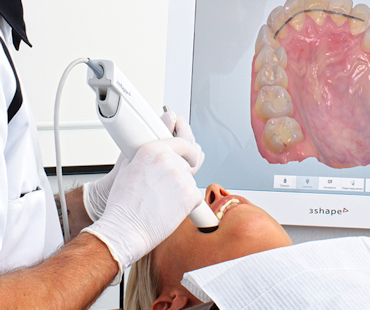Scanner intraoral para registo digital